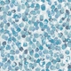 Click Here to Order Free Sample of Lissa Sky Blockout New Blinds